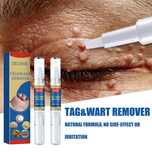 Skin Tag Treatment Pen for Precise At-Home Spot Care