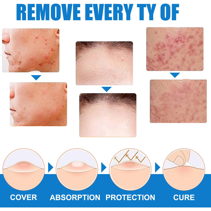 Topical Gentle Daily Skin Care Cream