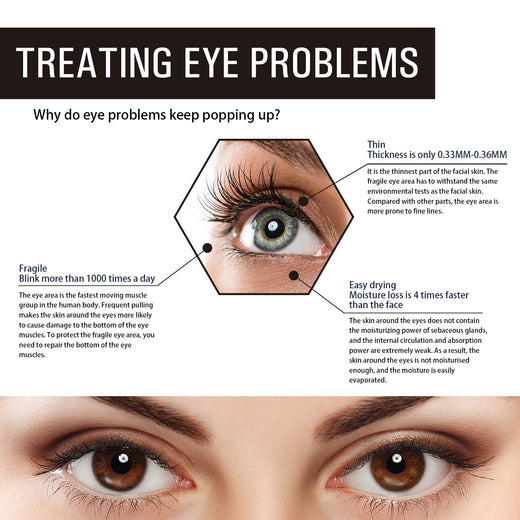 Retinol Eye Cream for Fine Lines & Under-Eye Wrinkles