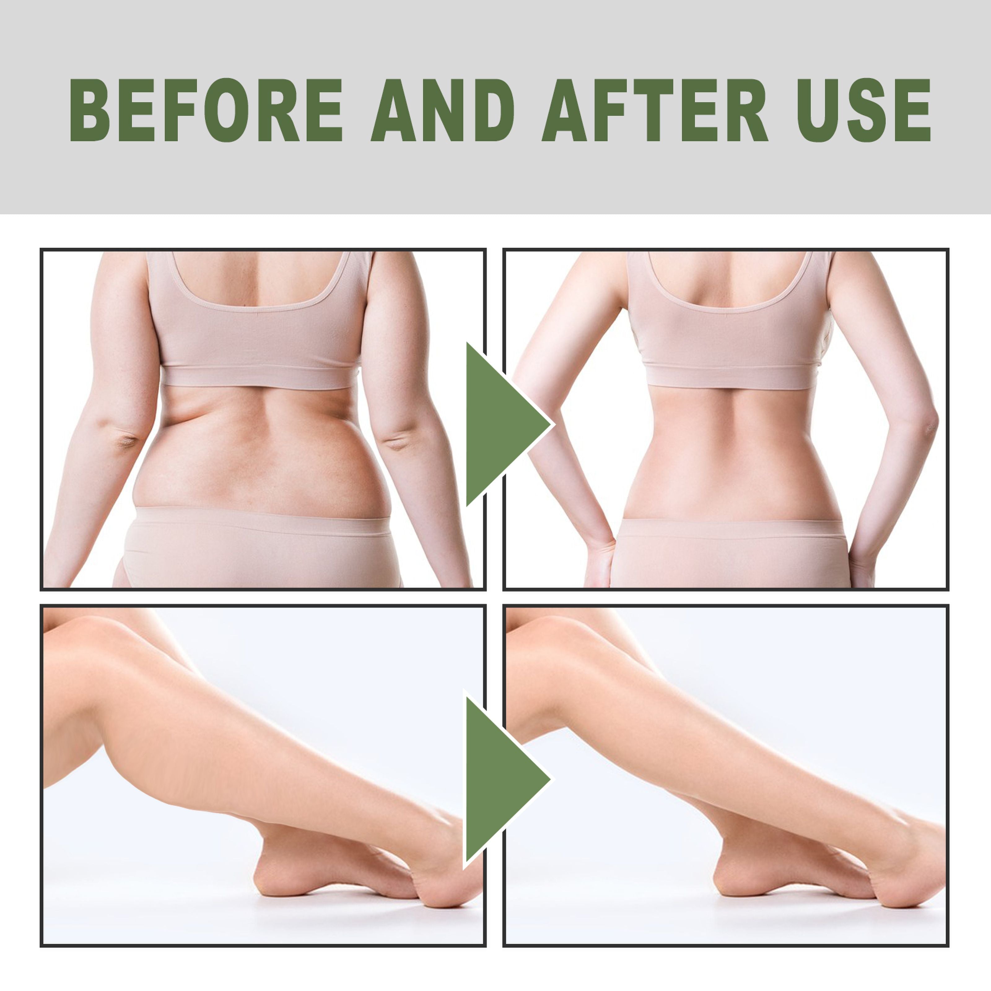 Infographic displaying three body concerns (excess fat, poor skin, poor metabolism) paired with aspirational image of toned woman in lingerie