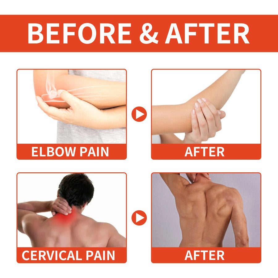 Bee Venom Joint Pain Relief Patches — 24-Hour Natural Relief