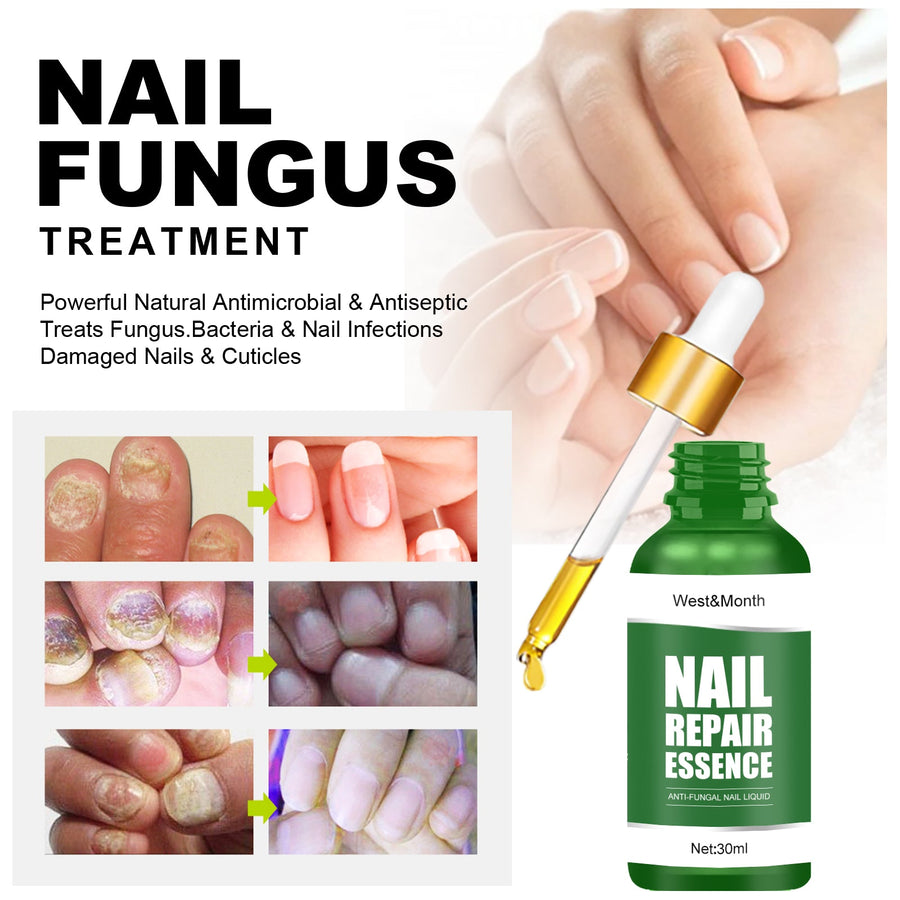 Nail Repair Essence — Anti-Fungal Treatment for Damaged Nails