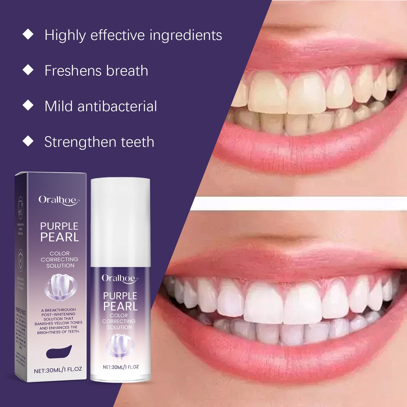 Split-screen comparison showing teeth before and after use with key benefits listed
