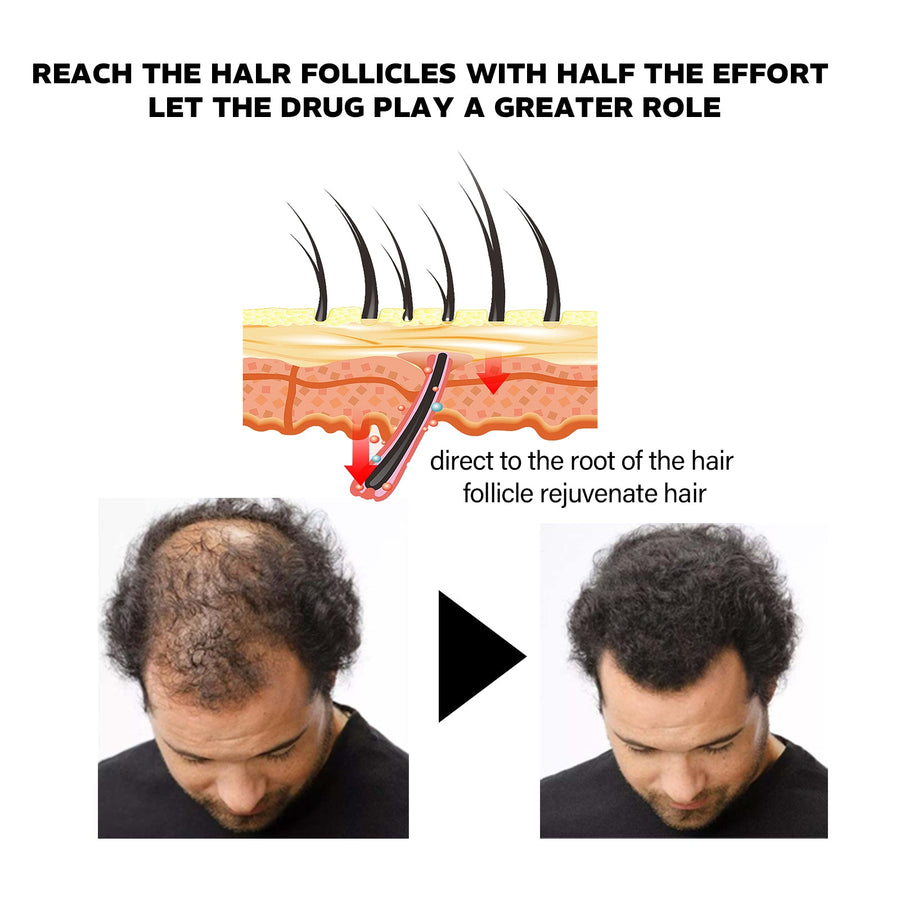 Hair Growth Oil for Targeted Root Nourishment Care