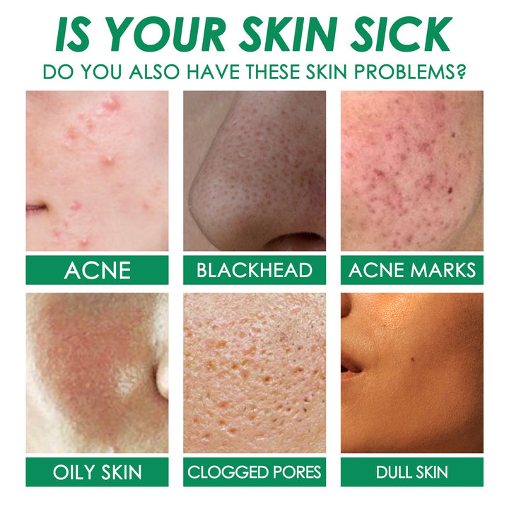 Green Tea Clay Mask Sticks for Acne & Clogged Pores