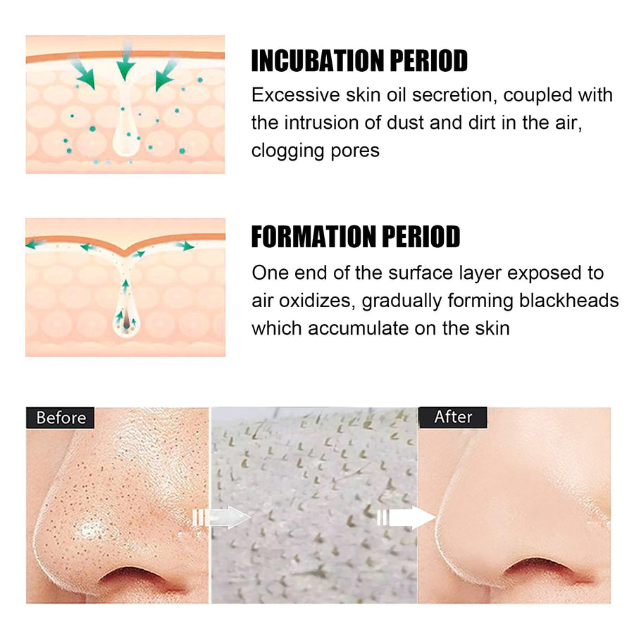 Green Tea Peel-Off Nose Mask For Blackhead Removal