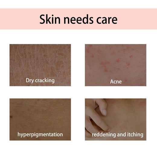 Handcrafted Body Oil for Firming, Hydrating & Soothing Skin