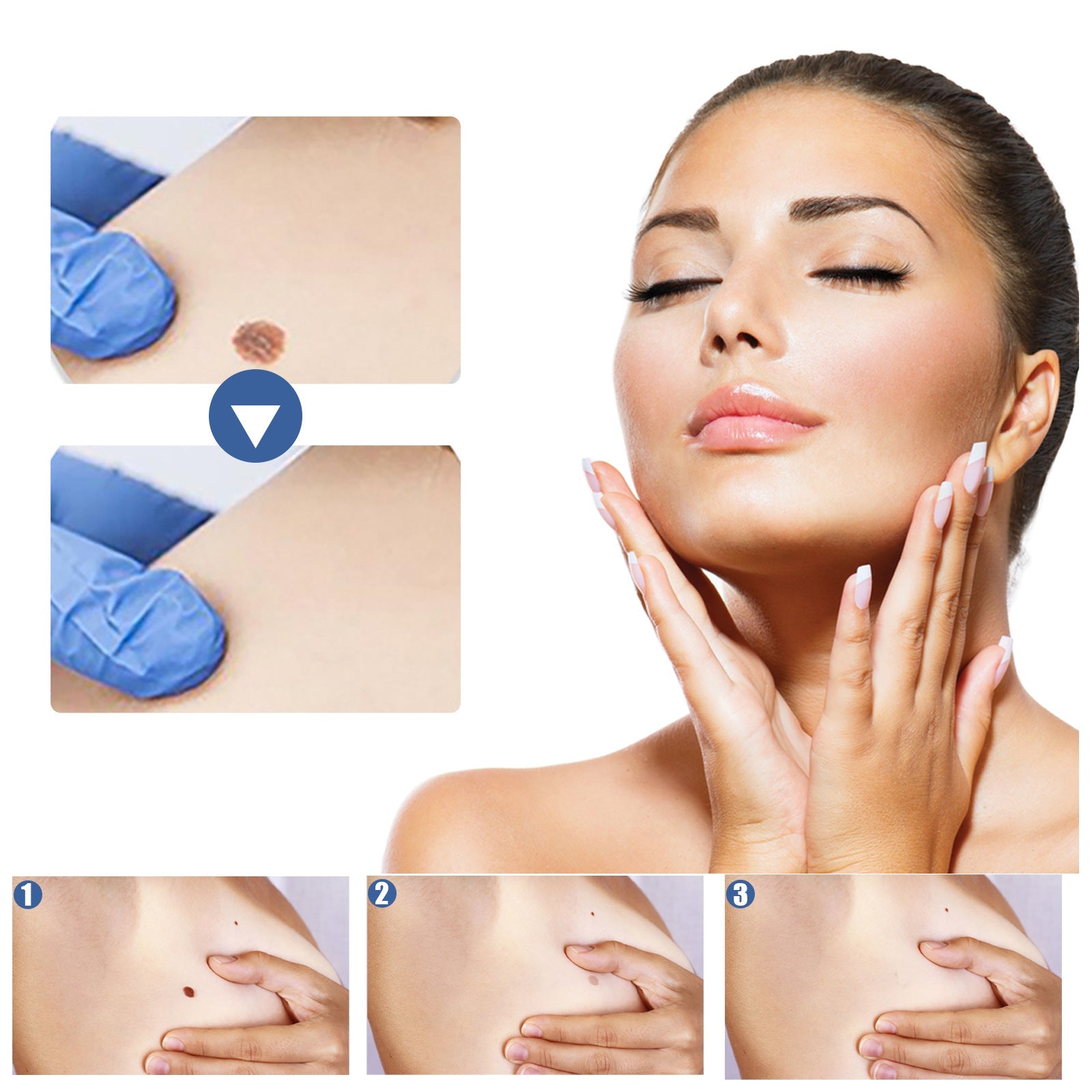 EELHOE Skin Tag Patches box and full grid of 144 transparent patches with feature list and clinical imagery