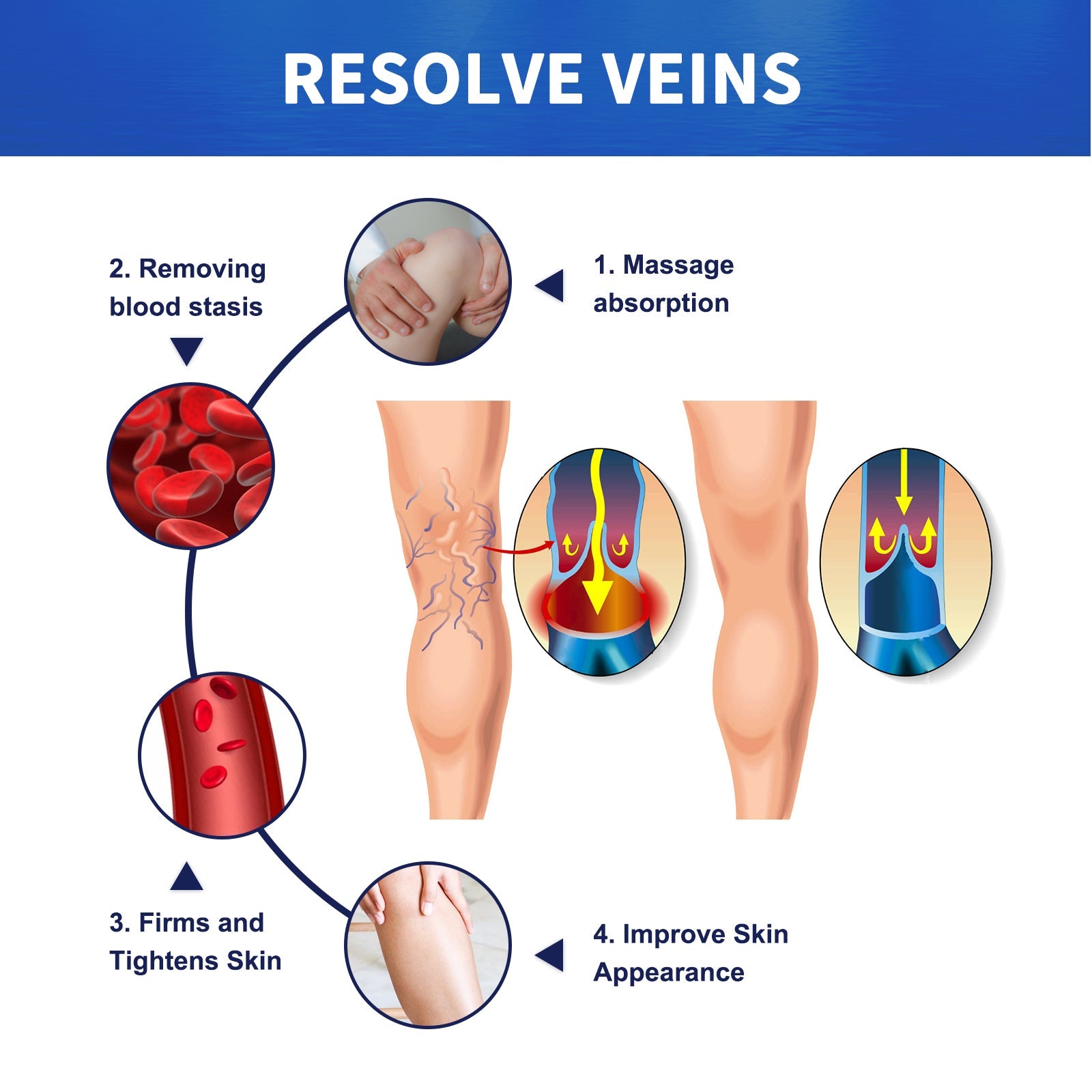 Lifestyle image of pink gloved hands applying cream to leg with visible varicose veins