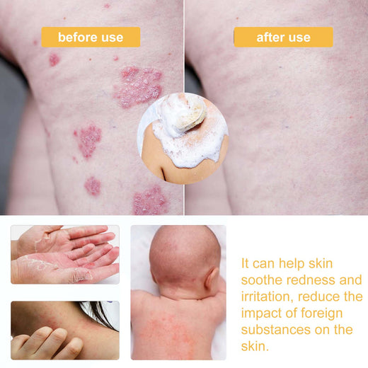 Honey Shower Gel for Sensitive Skin Moisture Relief