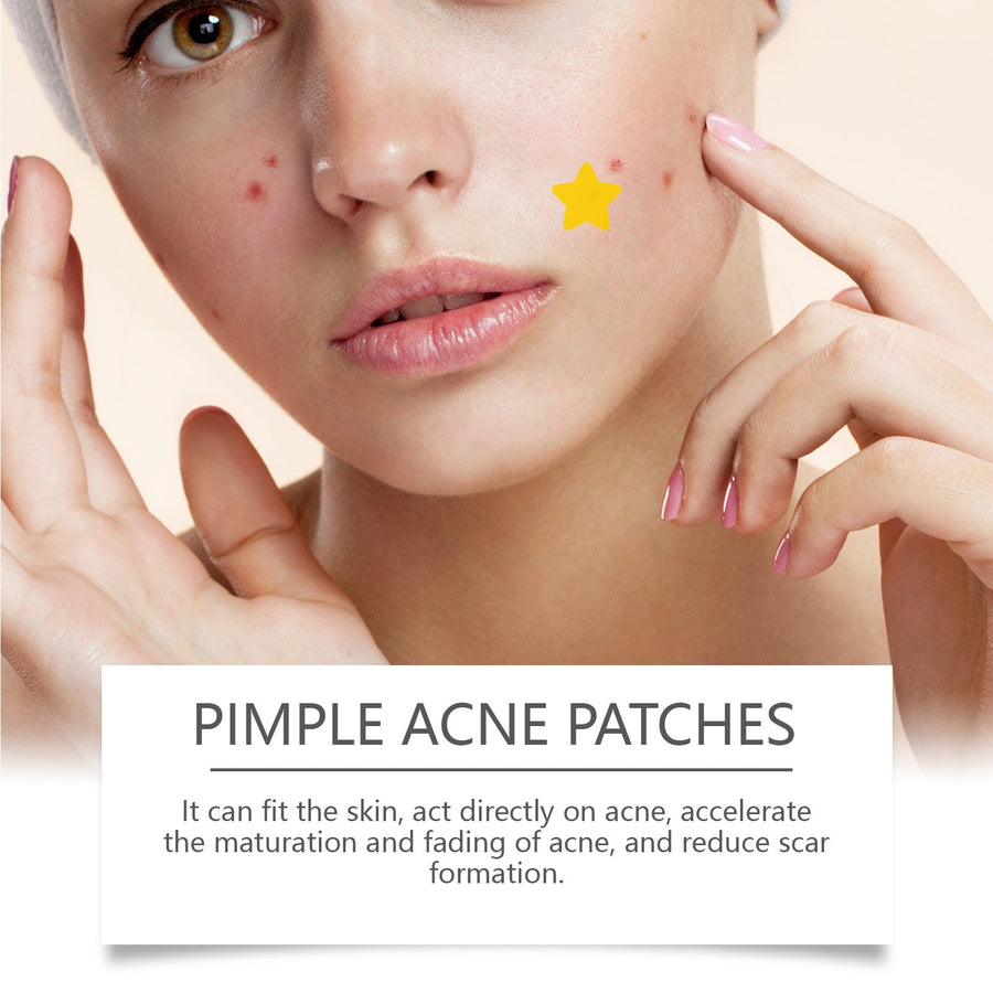 Pimple Patches 180 Count - 6-8 Hour Acne Absorption