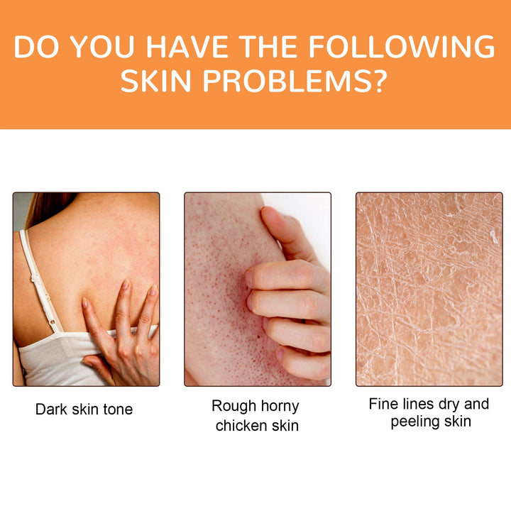 Vitamin C Body Oil for Dark Spots & Bumpy Skin