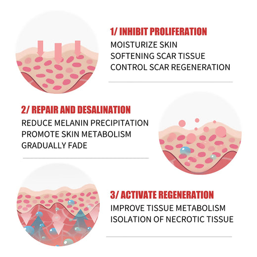 Skin Repair Cream – Natural Scar Reduction Treatment, 20g