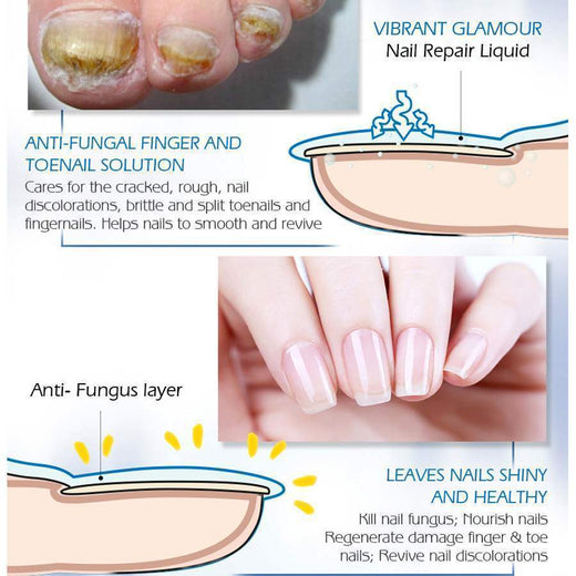 Fungal Toe Nail Treatment for Smoother, Healthier Nails