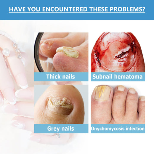 Nighttime Fungal Nail Treatment Patches — Visible Results