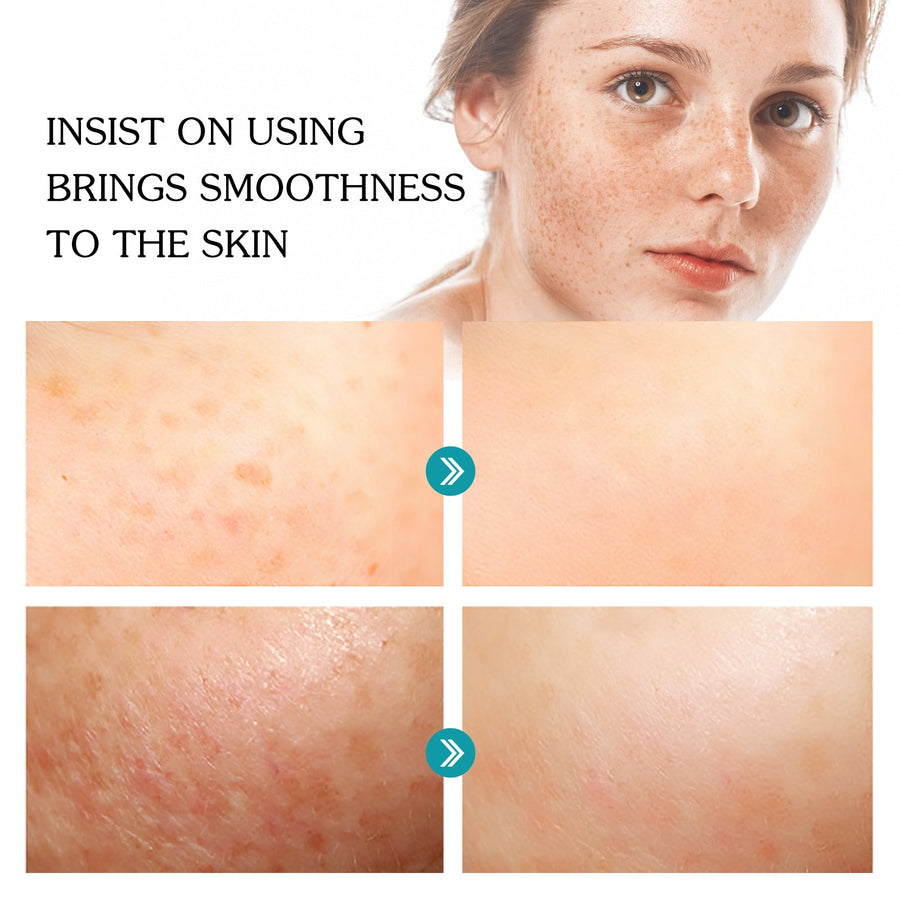 Niacinamide Serum for Dark Spots & Brighter-Looking Skin