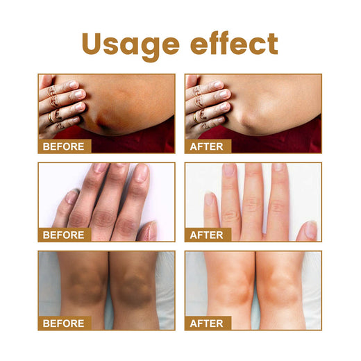 Skin Whitening Serum for Hands & Joints — Fade Dark Patches
