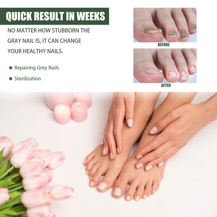 Daily Gentle Toenail Care Set