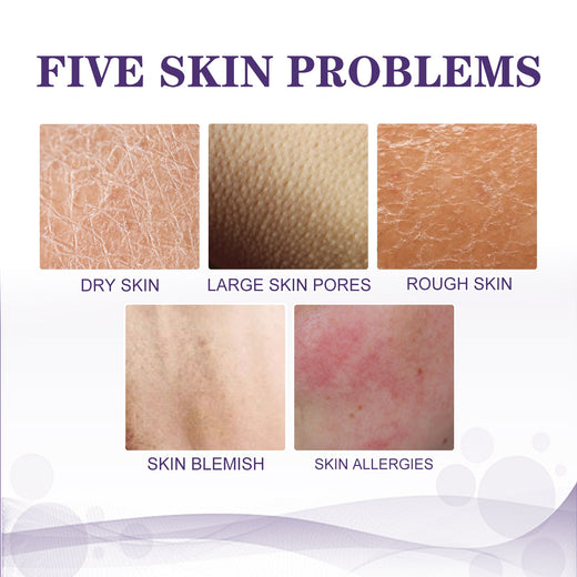 KP Bump Remover Cream for Smoother, Softer Skin
