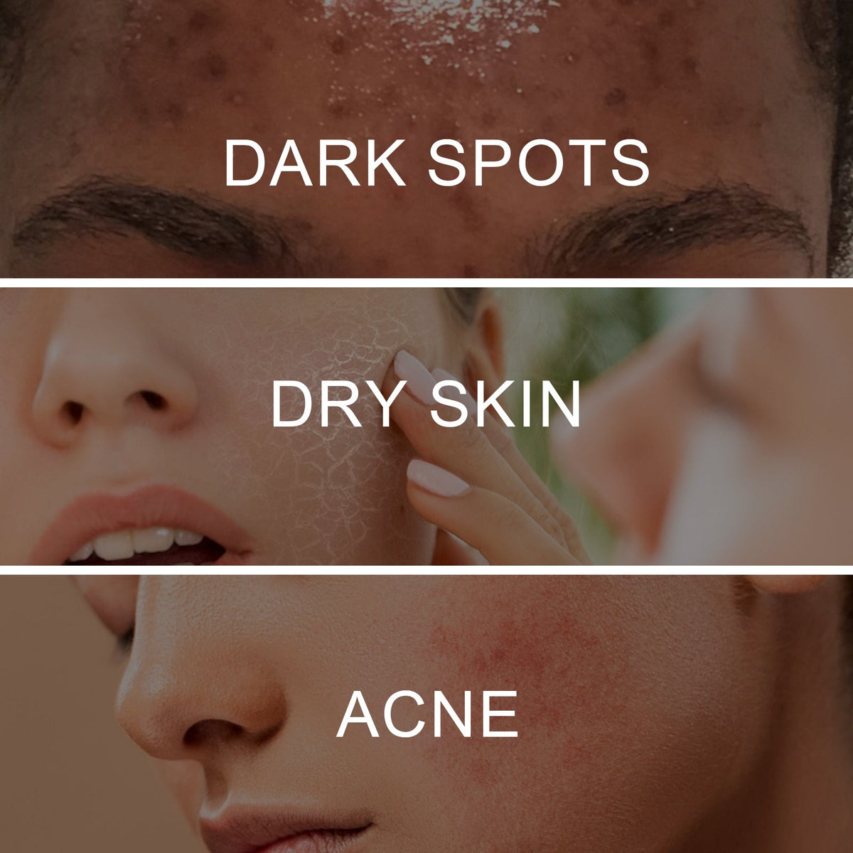 Retinol Spot Correcting Spray for Dark Spots & Tone