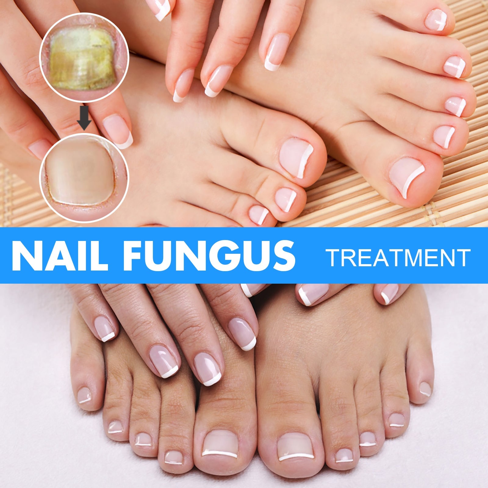Hand and foot imagery showing healthy restored nails with clean French manicure appearance after treatment