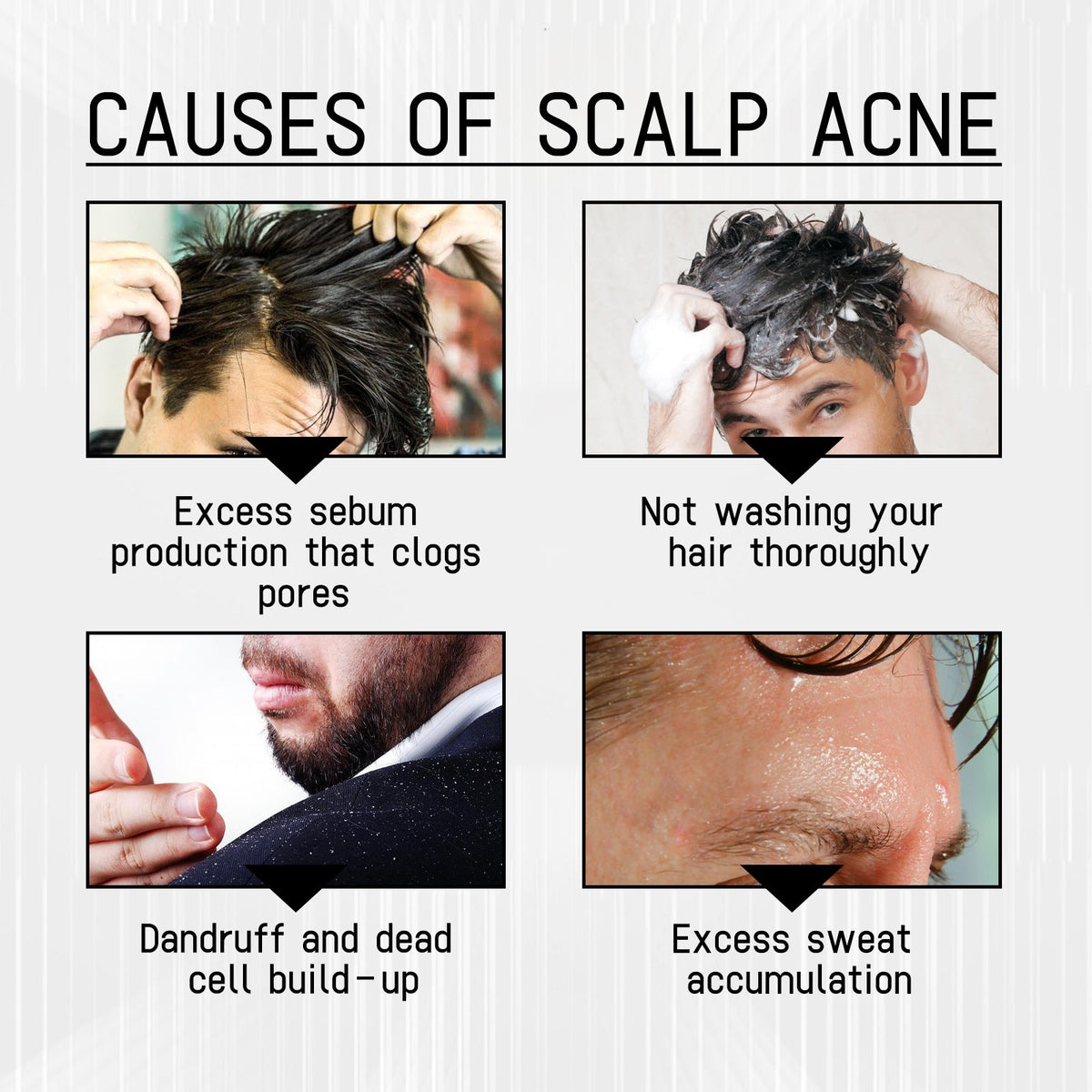 Anti-Shedding Hair Spray for Targeted Hairline Care