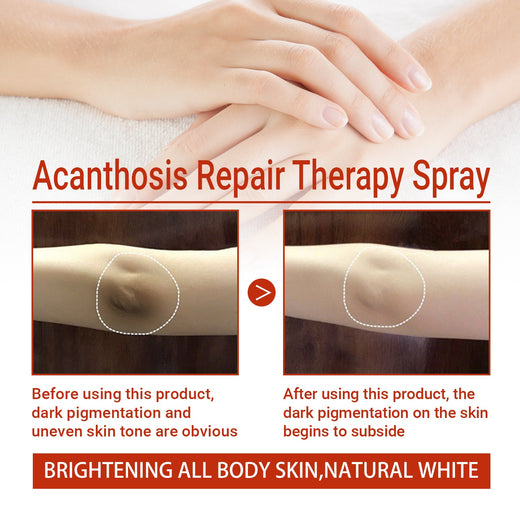 Underarm Dark Spot Spray for Brightening Rough Skin