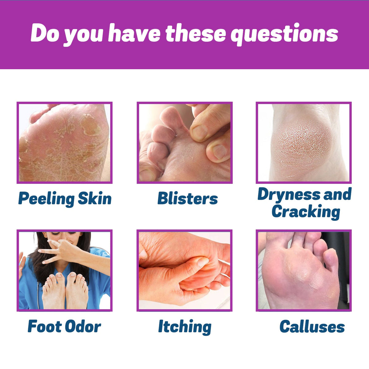 Foot Odor Spray That Kills Bacteria In Seconds