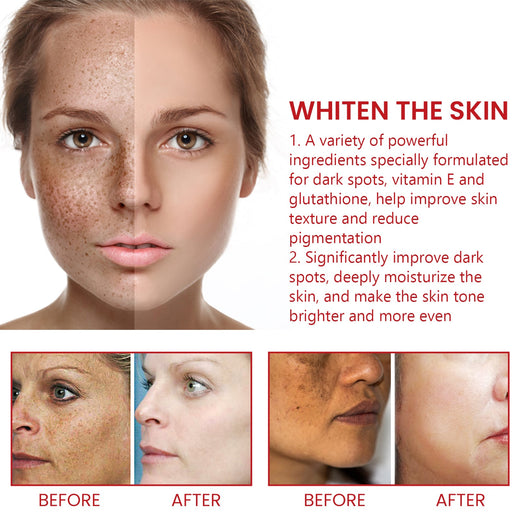 Dark Spot Repair Cream With Vitamin E & Glutathione
