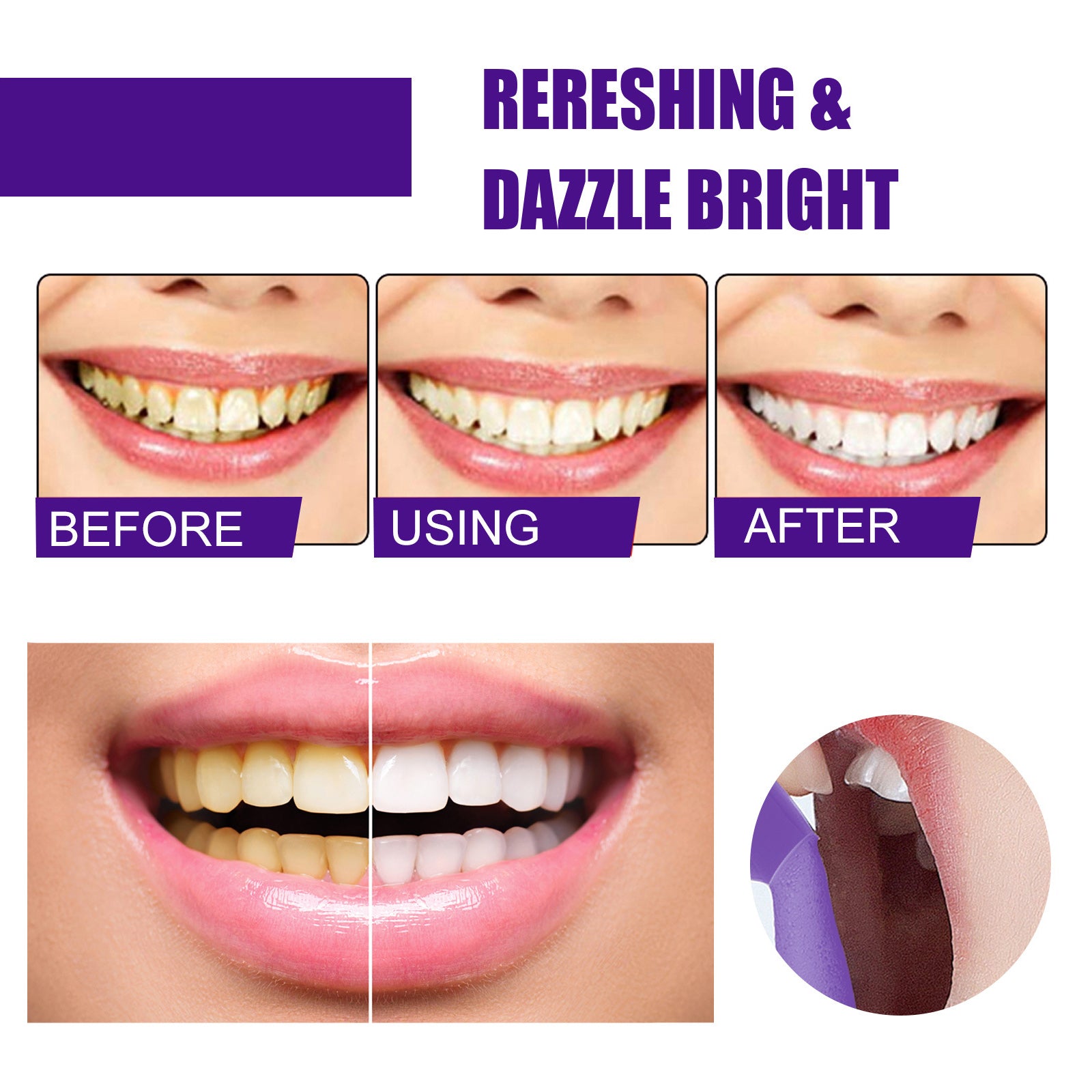 Three-stage progression showing before/using/after teeth whitening with significant yellow stain removal and brightening effect