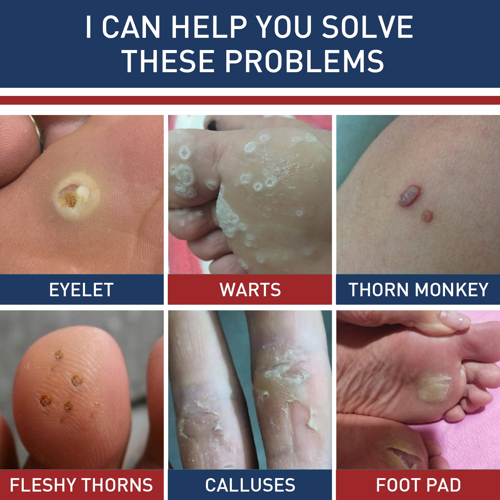 Six-panel problem grid showing eyelet, warts, thorn monkey, fleshy thorns, calluses, and foot pad conditions