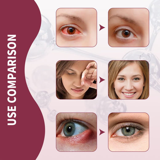 Eye Relief Serum for Redness, Swelling & Dry Eye Care