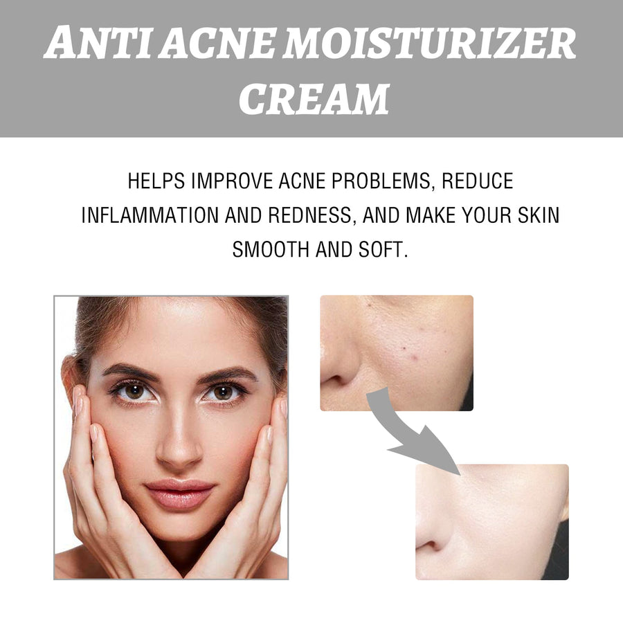 Hydrating Cream Hydrating And Lightening Facial Acne Repair