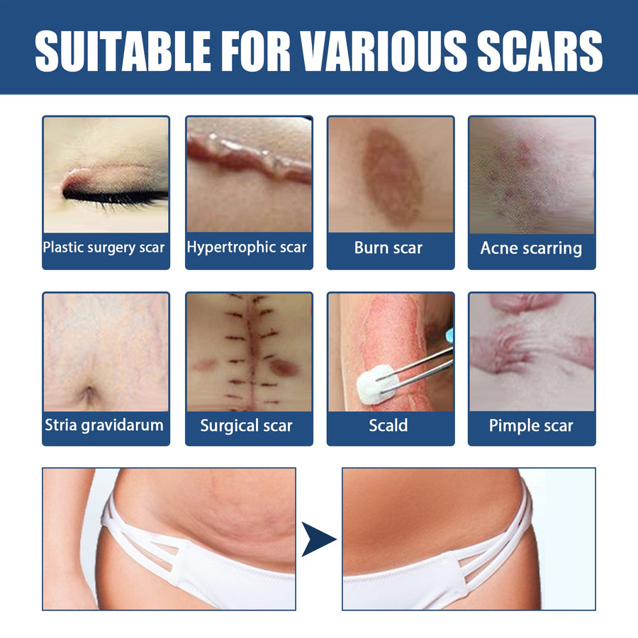 Scar Balm for Surgical Scars — Visible Fading in Weeks