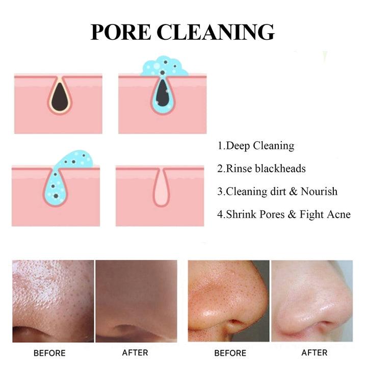 Blackhead Removal Peel Off Mask for Deep Pore Cleansing
