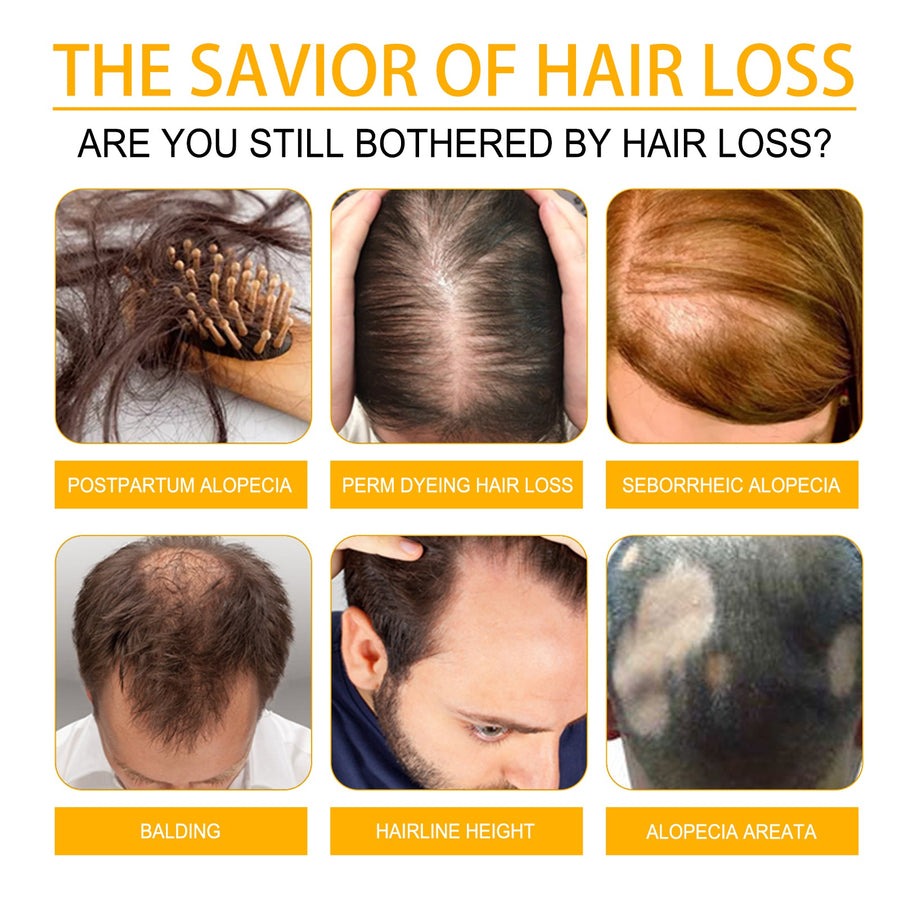 Biotin Hair Growth Serum — Stop Hair Loss, Visible Density