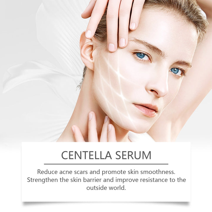 Centella Essence Serum for Rough, Reactive Skin Barrier