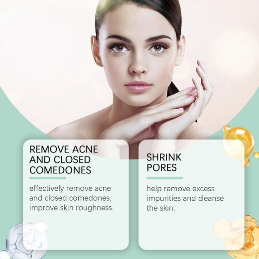Cucumber Toner That Calms Acne Before It Starts