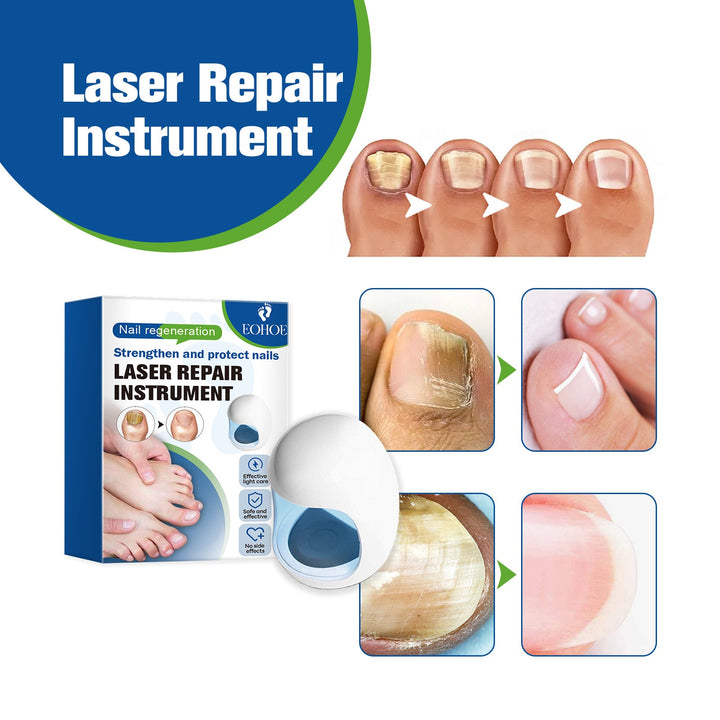 EOHOE Laser Nail Device for Fungal Nail Care at Home