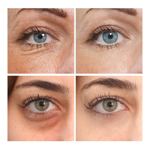 Gold Hydrogel Eye Patches for 15-Minute Eye Refresh