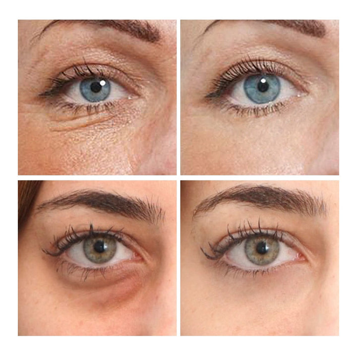 Gold Hydrogel Eye Patches for 15-Minute Eye Refresh
