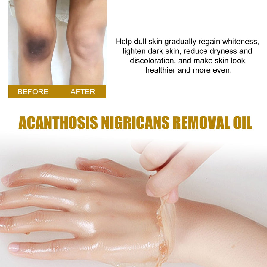 Dark Patch Exfoliating Oil for Elbows, Knees & Underarms