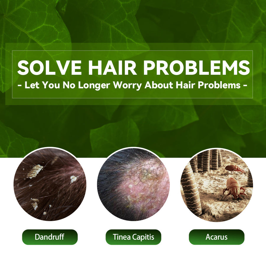 Anti-Dandruff Shampoo for Itchy, Oily Scalp Care