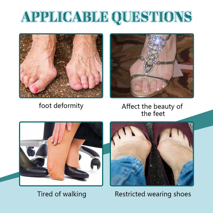 Bunion Relief Patch — Pain-Free Steps & Toe Alignment | EELHOE