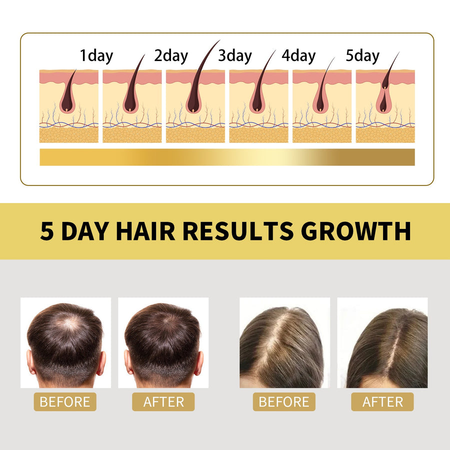 Ginger Shampoo for Itchy Scalp & Fuller-Looking Hair