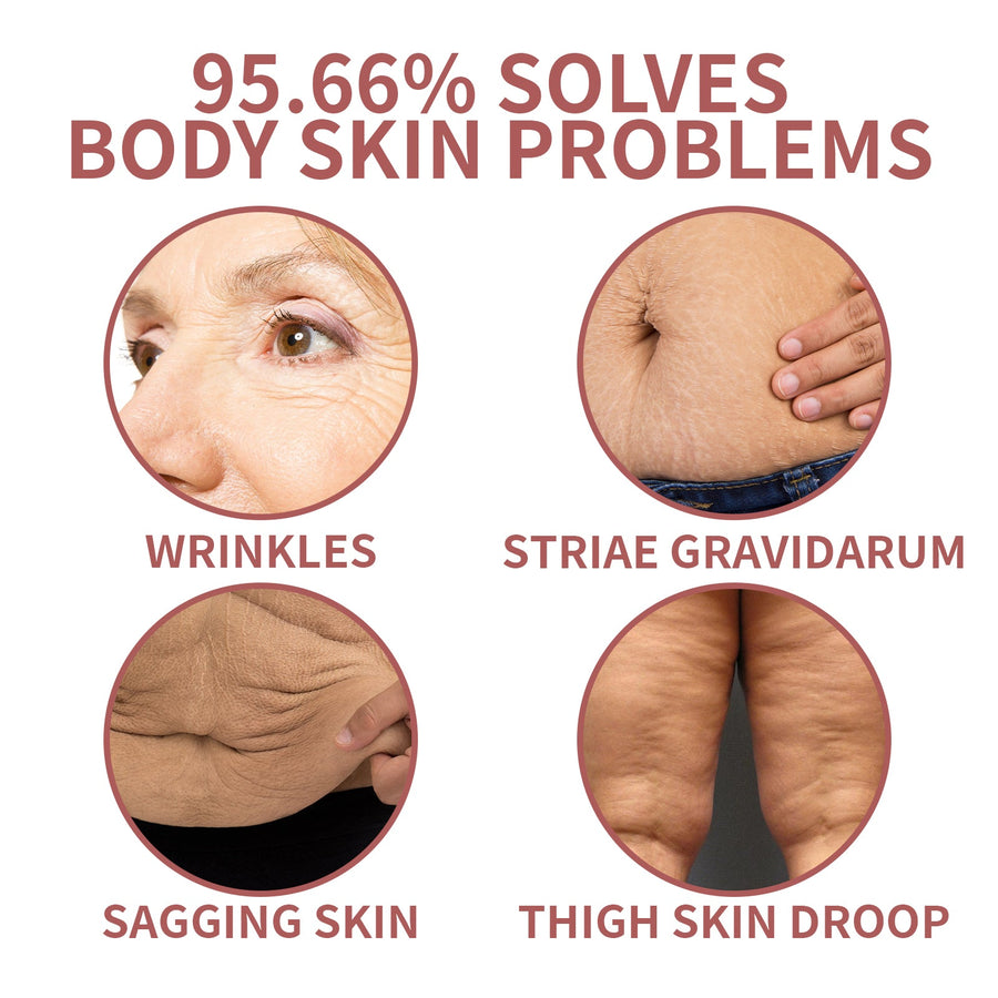 Body Firming Cream for Sagging Skin & Stretch Marks