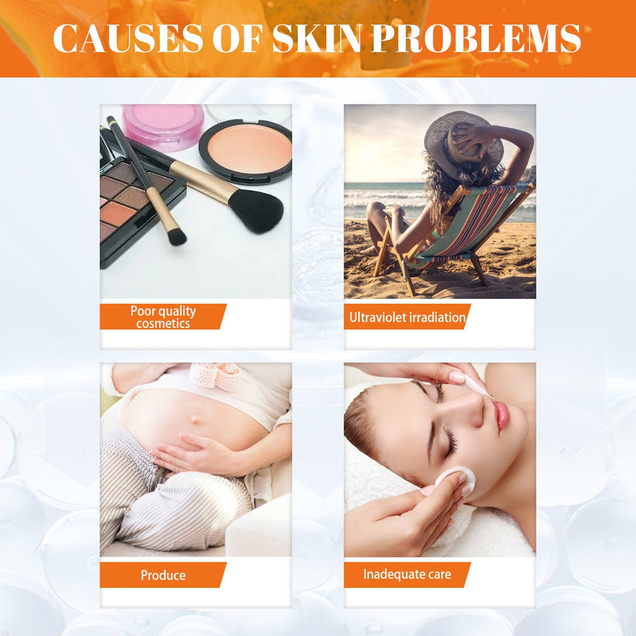 Papaya Freckle Cream Day Night Set for Dark Spots