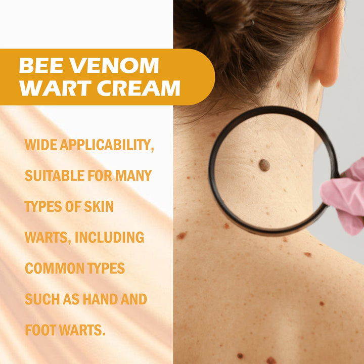 Bee Venom Wart Cream for Stubborn Hand & Foot Warts