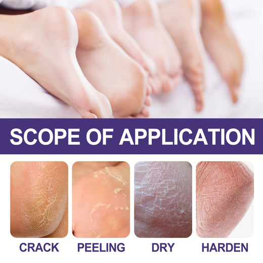 Herbal Body Cream for Cracked Heels & Dry Winter Skin