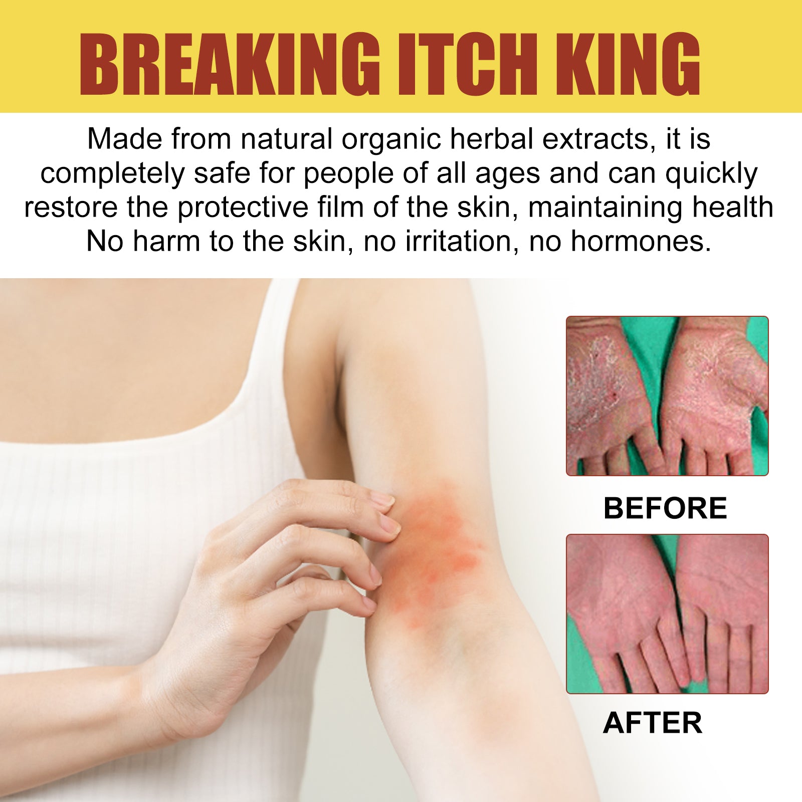 Detailed before/after comparison of hands showing fungal redness clearing and skin healing